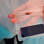 Бюджетный биочип для выявления аллергии разработали в Беларуси